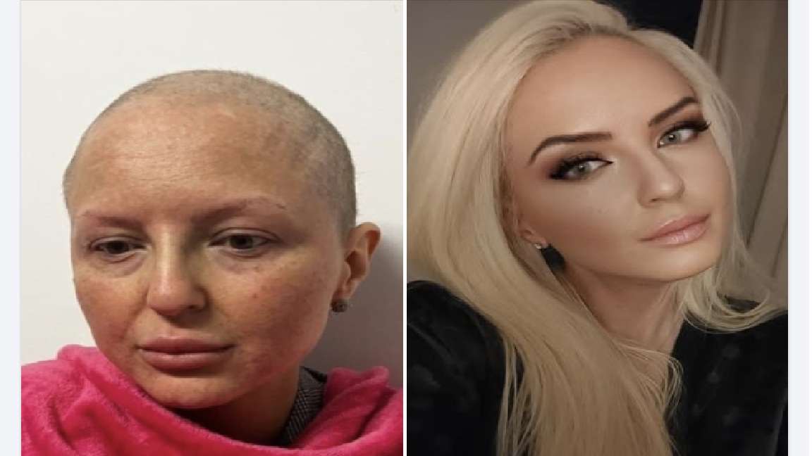 Liuba are nevoie urgentă de 5000 de euro pentru operația care îi poate salva viața