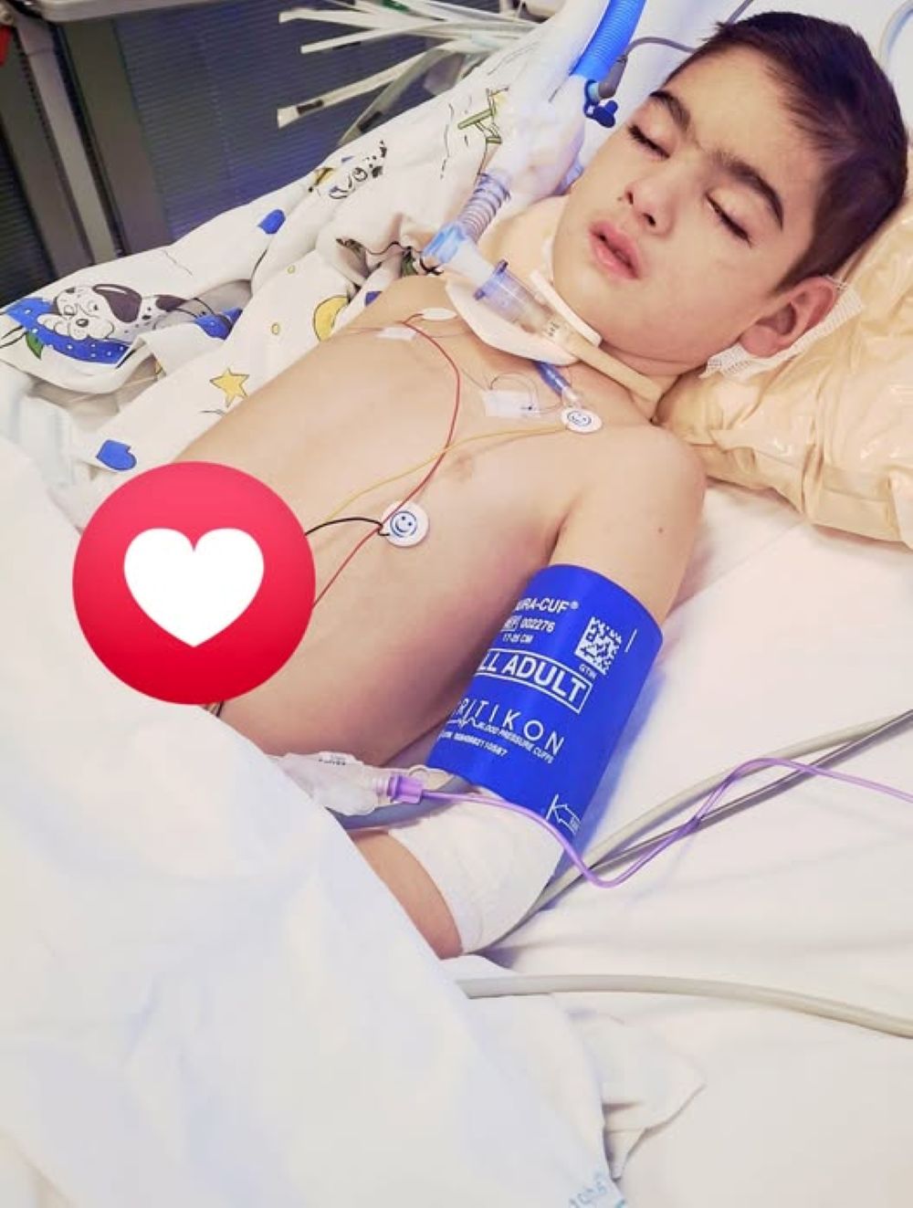 De mai bine de o lună, micuțul Antonio  este pe patul de terapie intensivă: Părinții disperați - Dorul de tine ne apasă în fiecare clipă