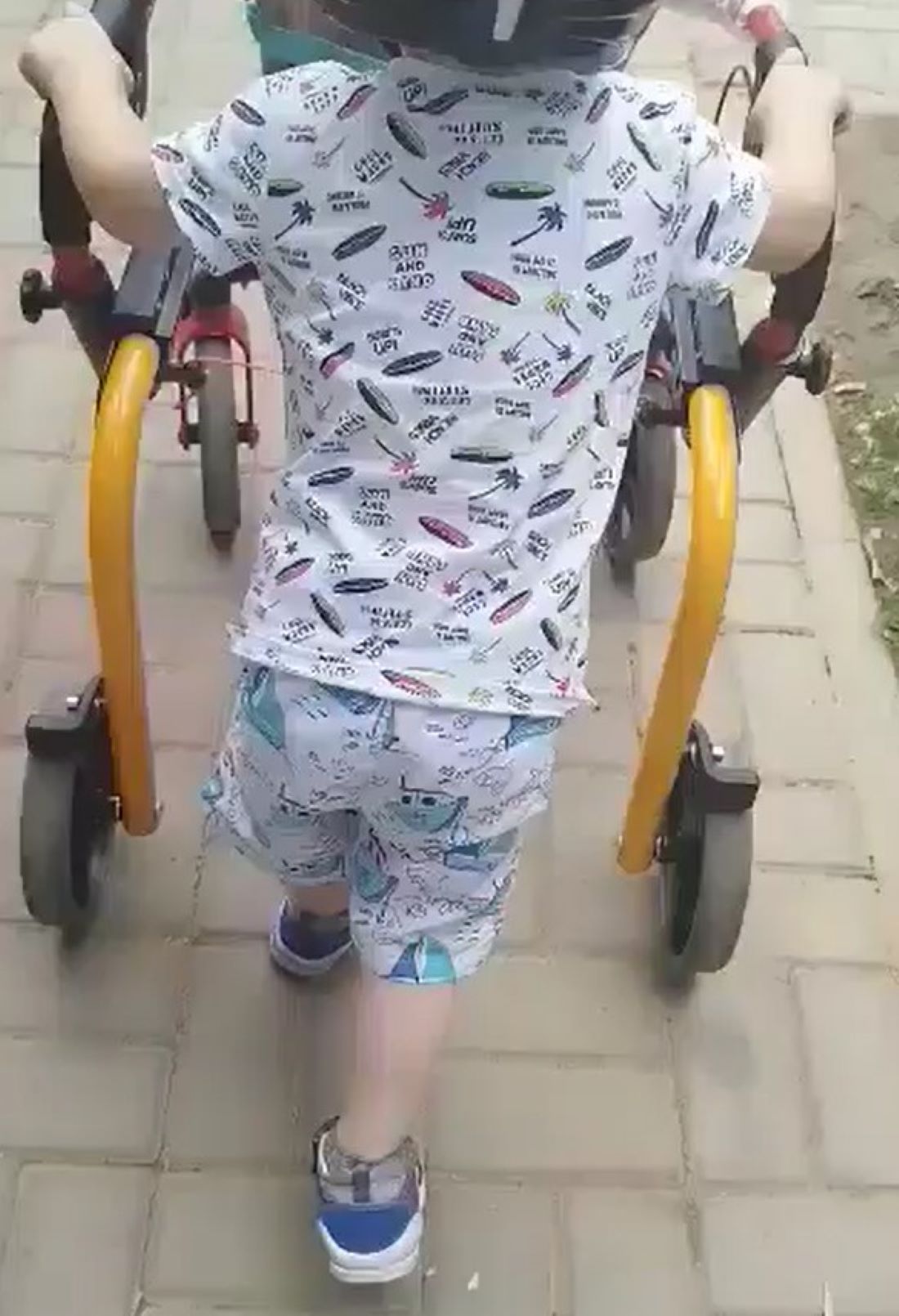 Lucas are nevoie de ajutor: Copilul se luptă cu paralizia cerebrală infantilă și diplegia spastică 