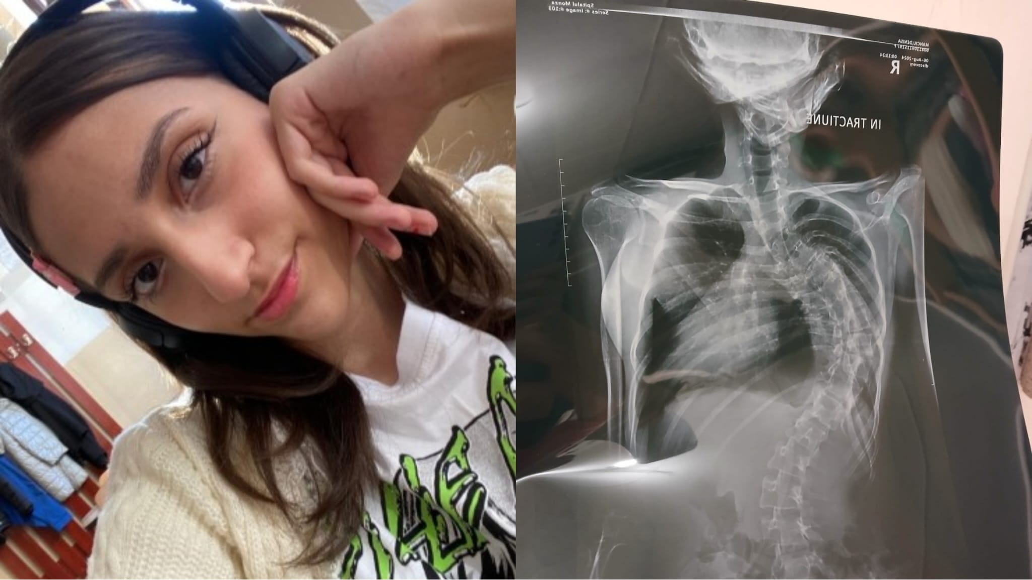 O boală gravă i-a furat libertatea: Denisa visează să devină medic psiholog