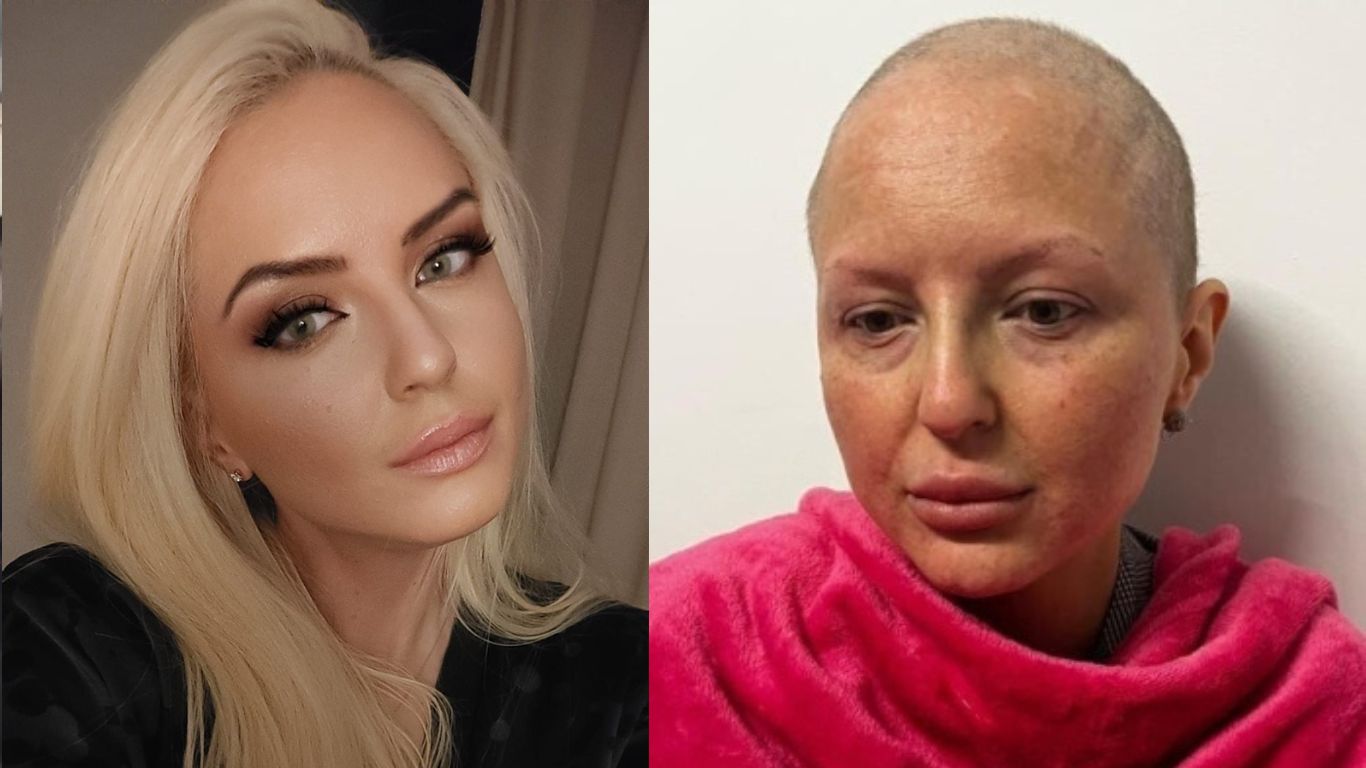 O femeie de 42 de ani, transformată total de un cancer agresiv. Te rog, din toată inima: Ajută-mă să trăiesc