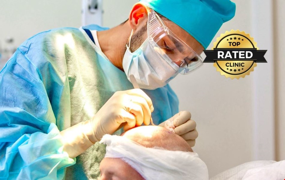 Transplant de păr: Cum să determini momentul potrivit pentru procedura ta 