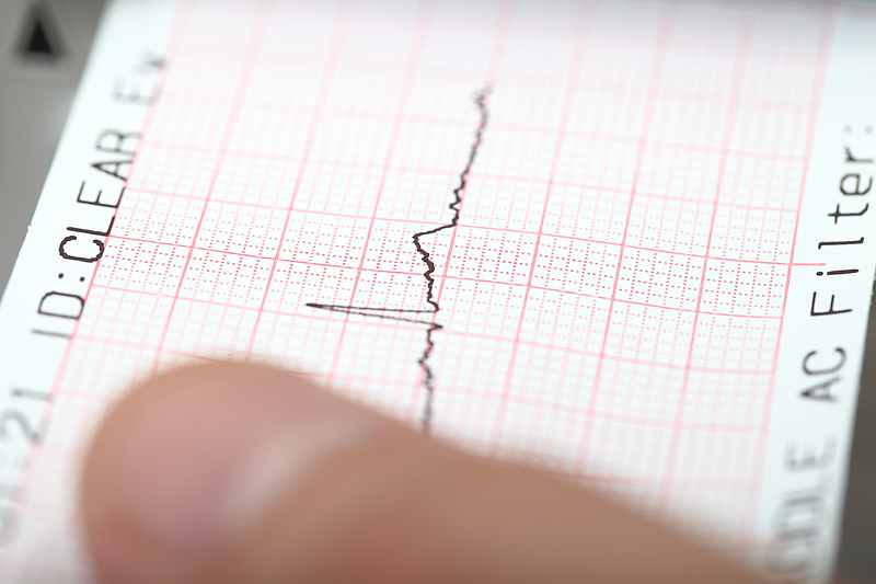 Cutremur de 6 grade în Kamceatka, la scurt timp după seismul major de 8,8