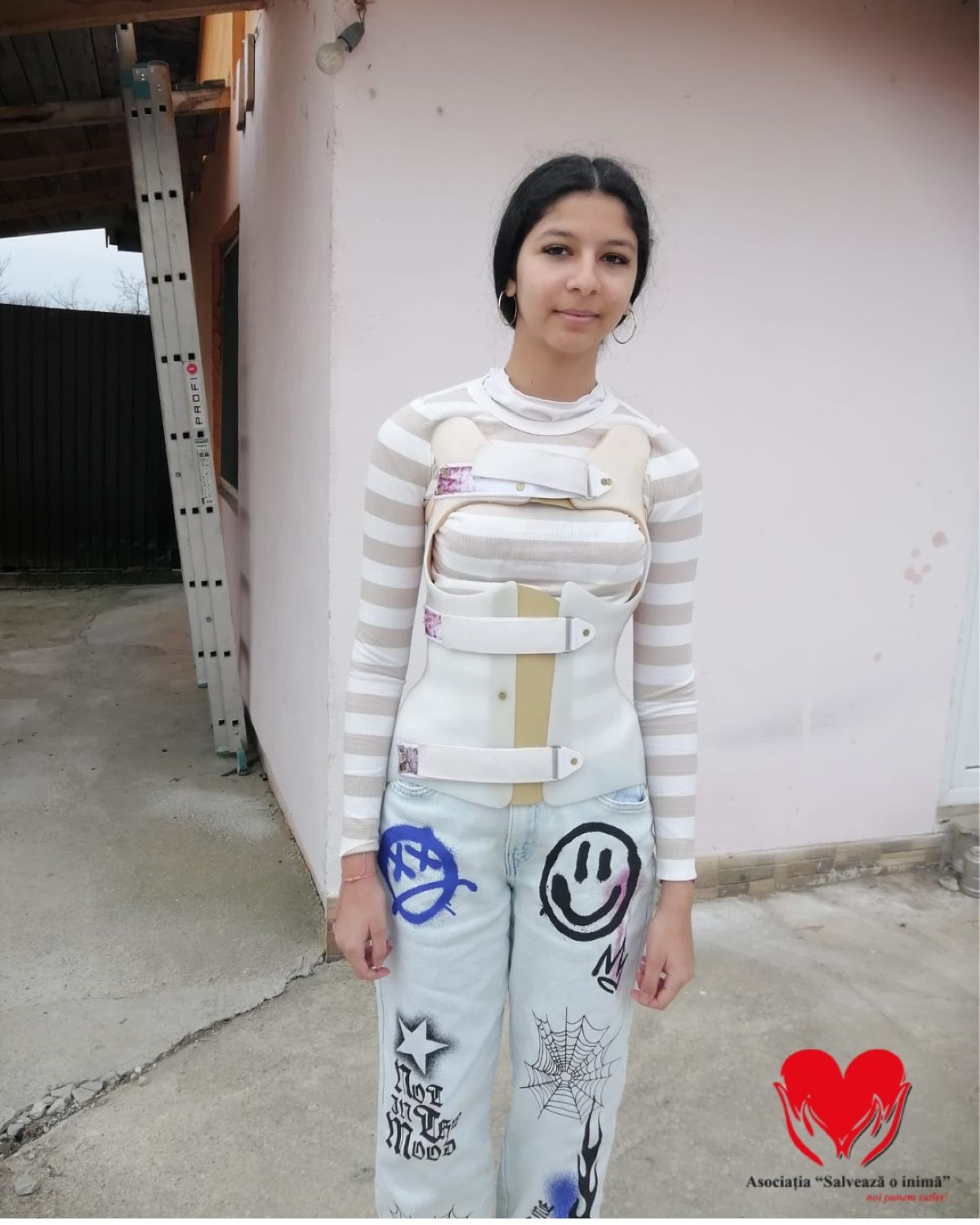 erika are nevoie de ajutor