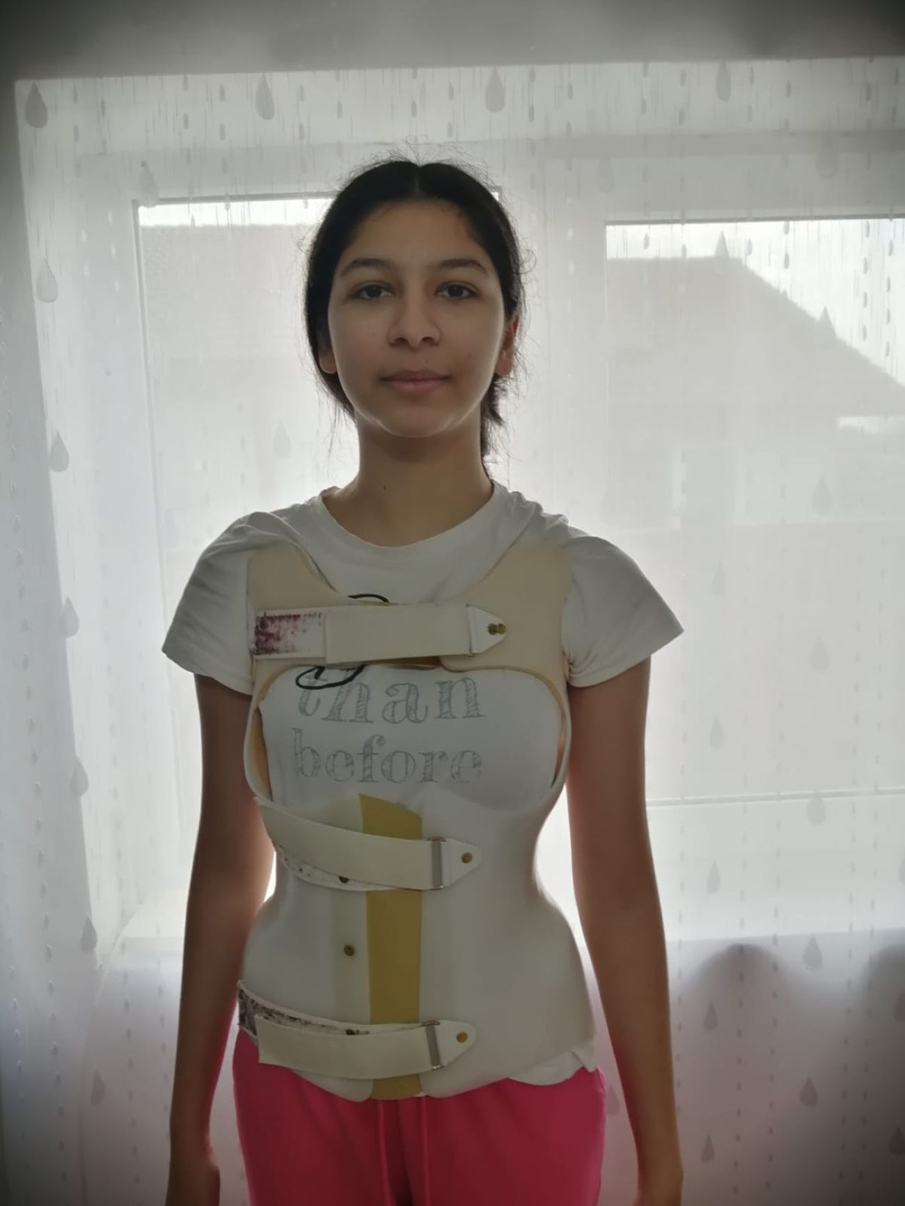 Strigăt disperat! O adolescentă pentru care părinții ei au făcut totul trebuie să se opereze 