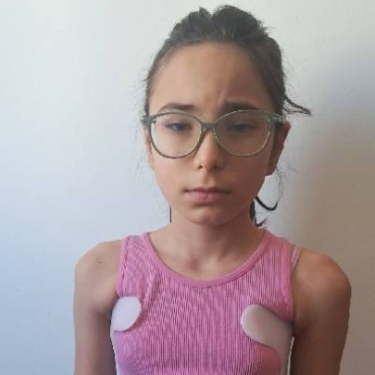 Coșmarul prin care trece o fetiță de cinci ani, totul a început după ce a înghițit un bănuț