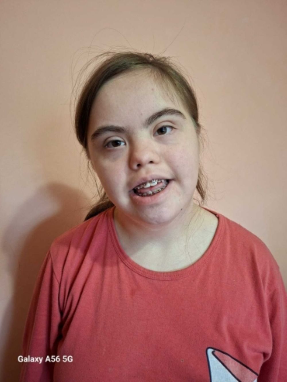 Ioana are nevoie de noi: O inimă mică luptă pentru fiecare bătaie