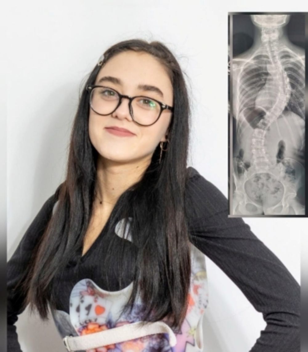 Apel către oamenii de bine: Miruna are nevoie de o operație salvatoare 