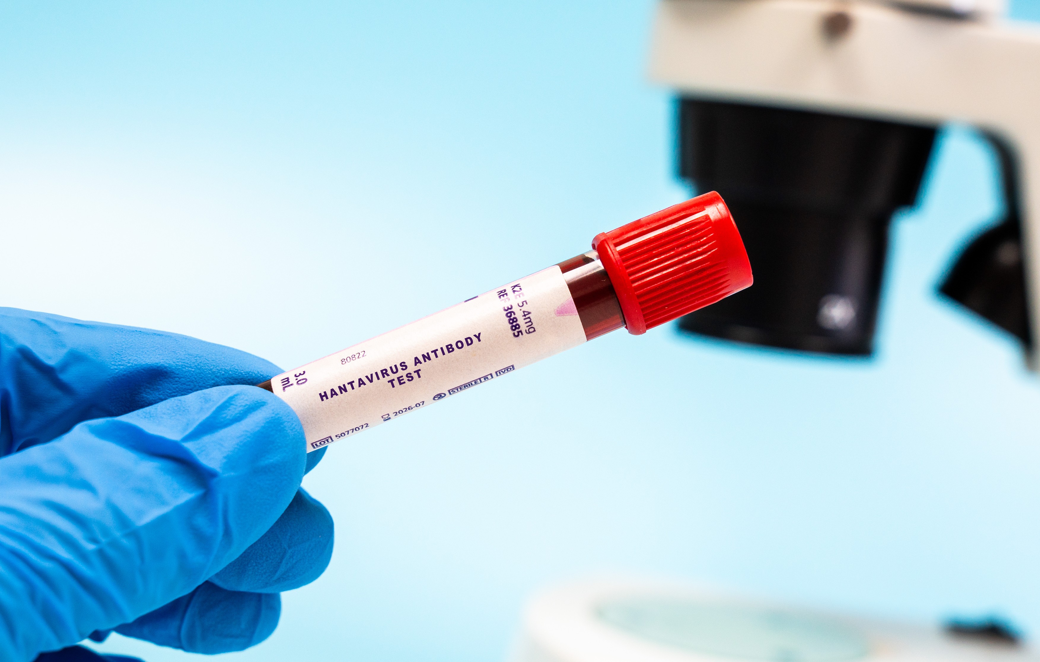 Caz de Hantavirus confirmat în România: Anunțul INSP