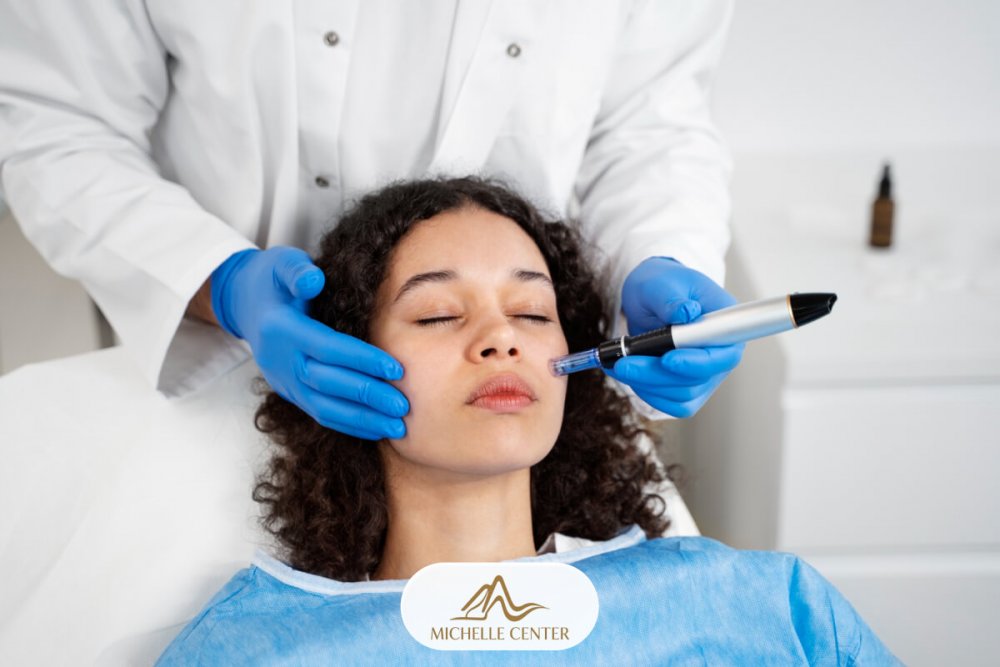 salon-michelle-femeie-salon-microneedling