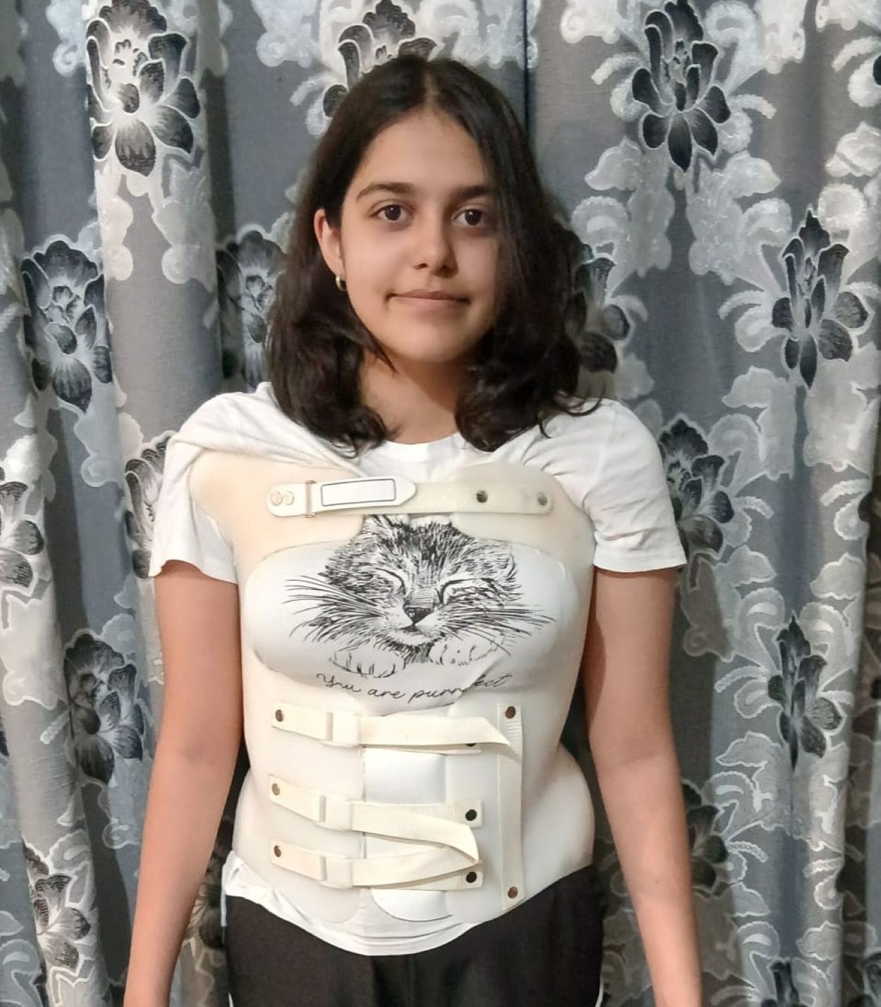 Sara, fetița care are nevoie de ajutor