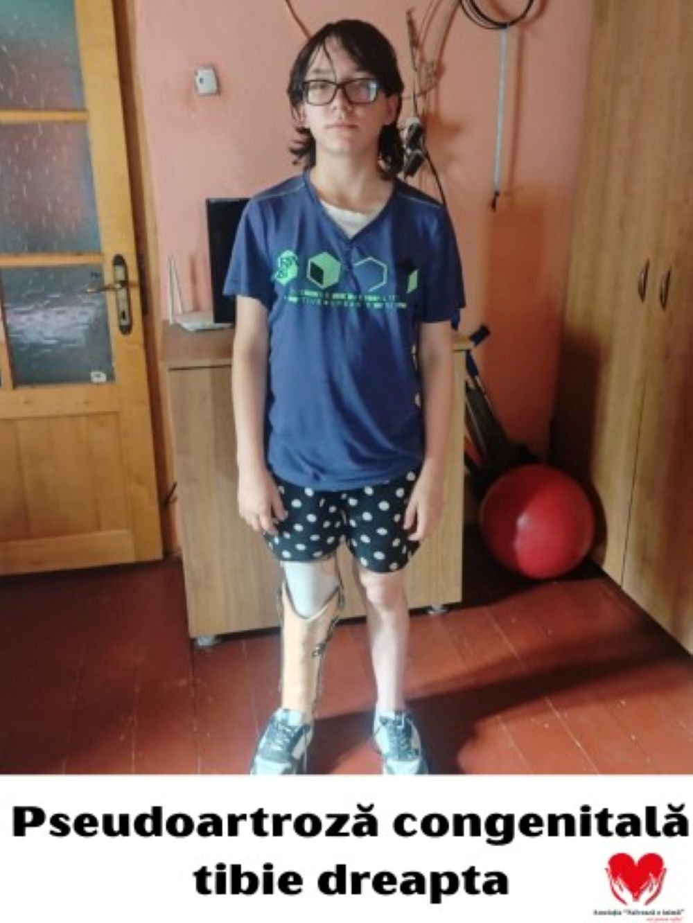 O fată care visează să devină medic trebuie operată urgent – APEL pentru salvarea ei  