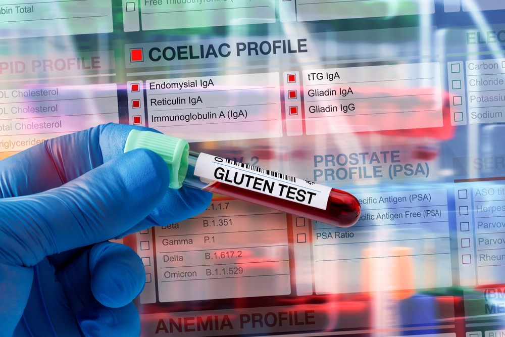 Test genetic simplu, esențial pentru depistarea predispoziției la boala celiacă la copii