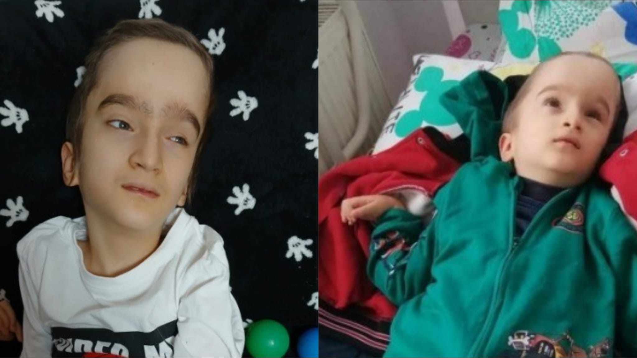 Un copil de doar 11 ani are nevoie urgent de operație: 10.000 de euro, șansa la o copilărie mai bună